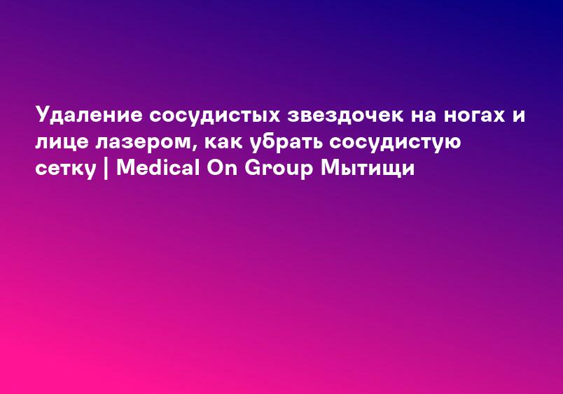 Удаление сосудистых звездочек на ногах и лице лазером, как убрать сосудистую сетку | Medical On Group Мытищи